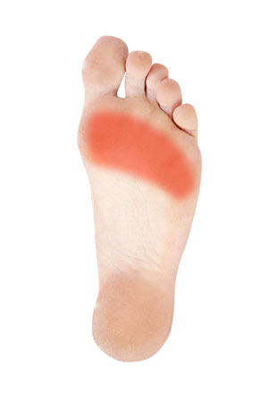 Forefoot Pain